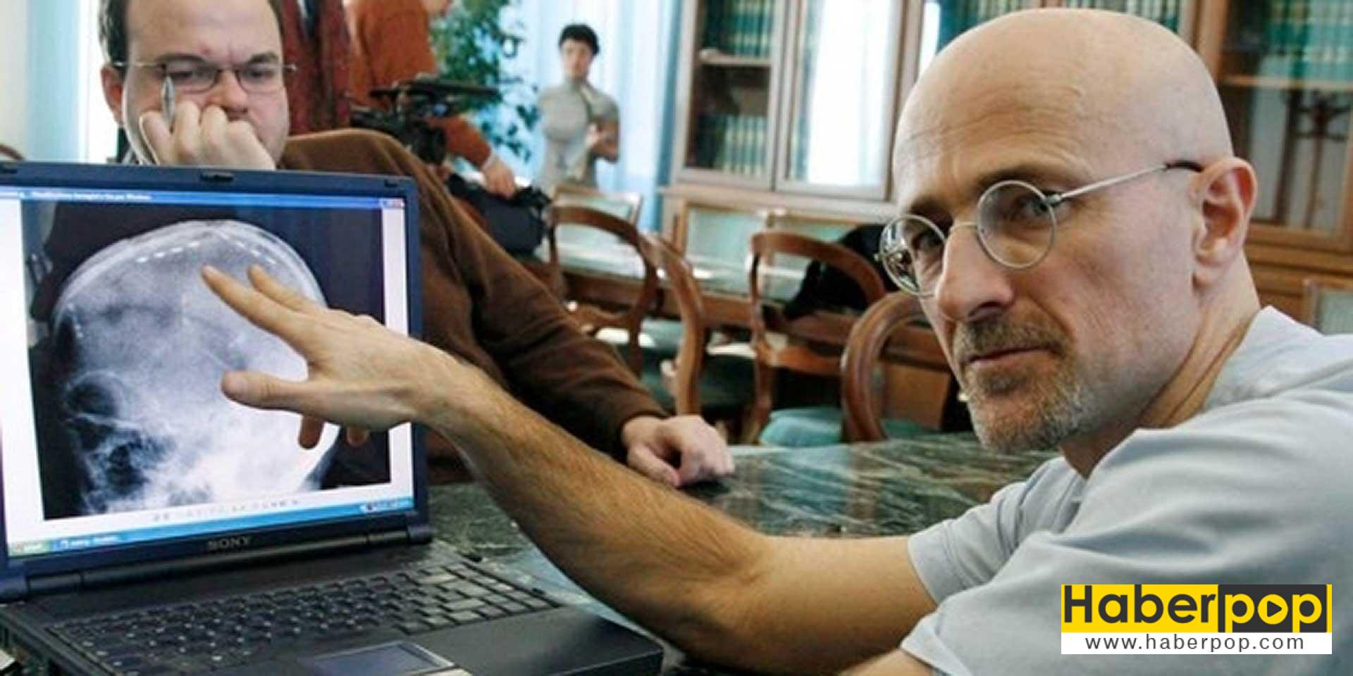 dunyanin-ilk-kafa-nakli-icin-gonullu-bulundu-tip