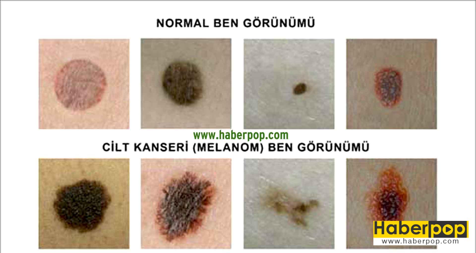 Ben Neden Olur Ben Neden Olur