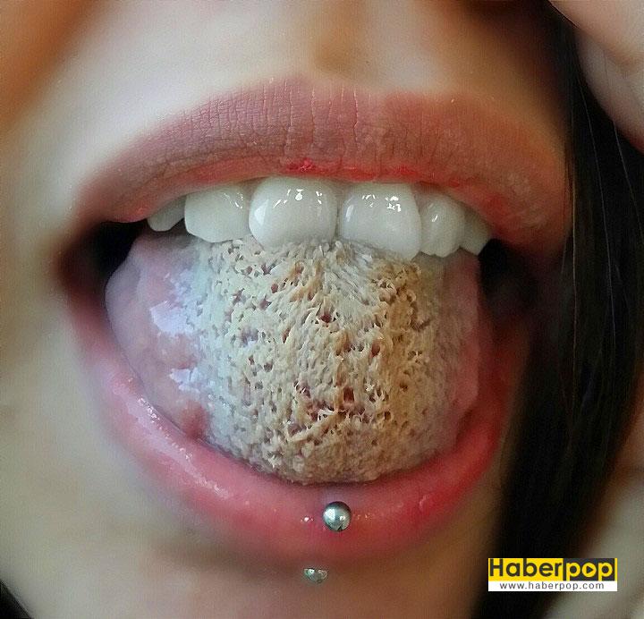 Tripofobi: Delik fobisi de denilen bir fobi çeşidi ‘Tropofobia’