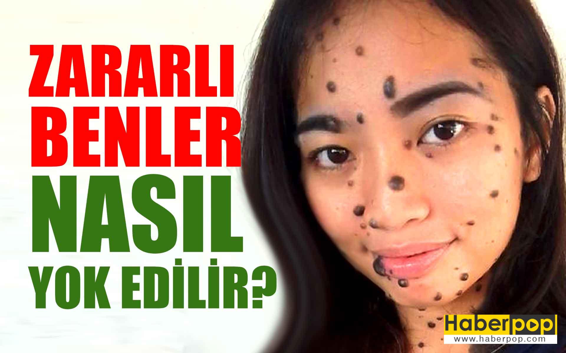 Dudak Üstü Tüylerinden Kurtulmanın Doğal Yolları Dudak Üstü Tüylerinden Kurtulmanın Doğal Yolları